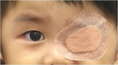 小儿斜视,小儿弱视,儿童眼科疾病,珠海希玛眼科