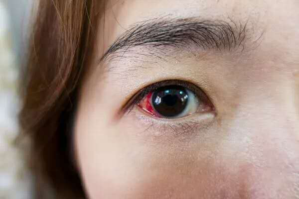 眼外伤急救方法,眼睛受伤怎么办,哪些容易发生眼外伤,眼外伤治疗医院